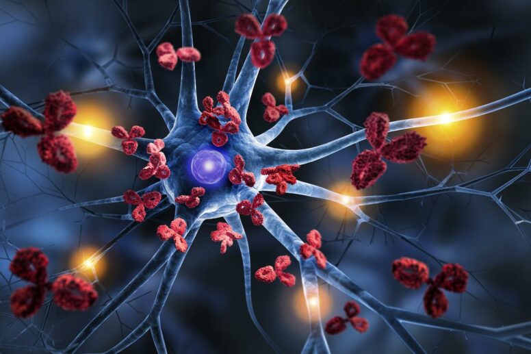 Neurones attaqués par le corps