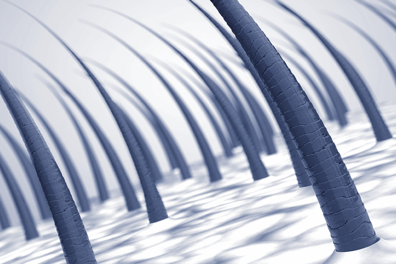 La perte de cheveux liée à la thyroïde : explications et solutions