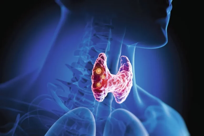 Votre naturopathe spécialisé dans les troubles thyroïdiens à Dijon